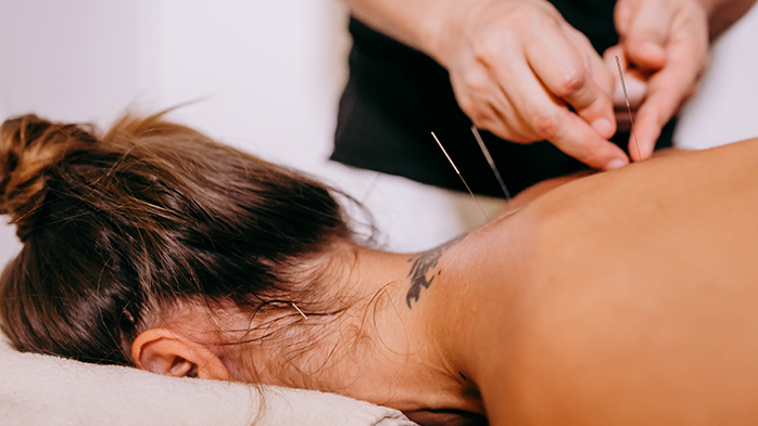 pexels-alma-thai-4353249-acupuncture-med